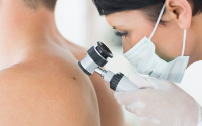 Skin cancer: how you can avoid a queasy feeling
