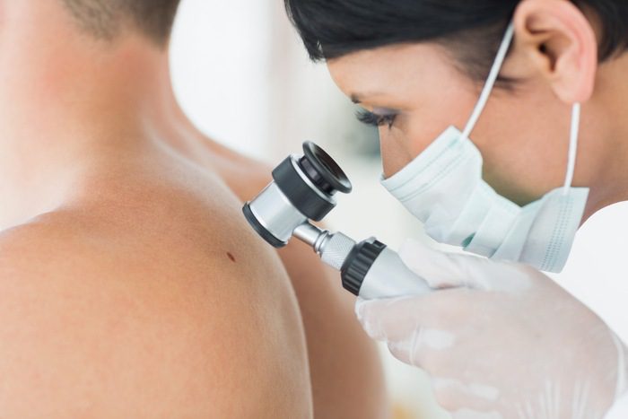 Skin cancer: how you can avoid a queasy feeling